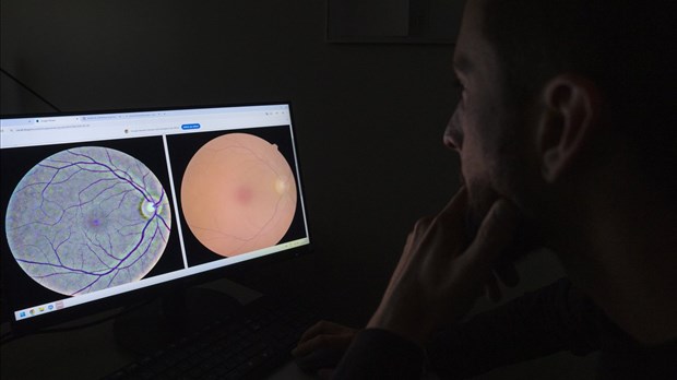 Une analyse de la rétine pourrait permettre de dépister une centaine de maladies